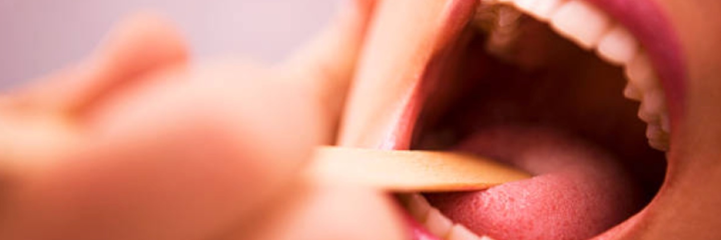 Header-Treating-Issues-With-Throat-1440